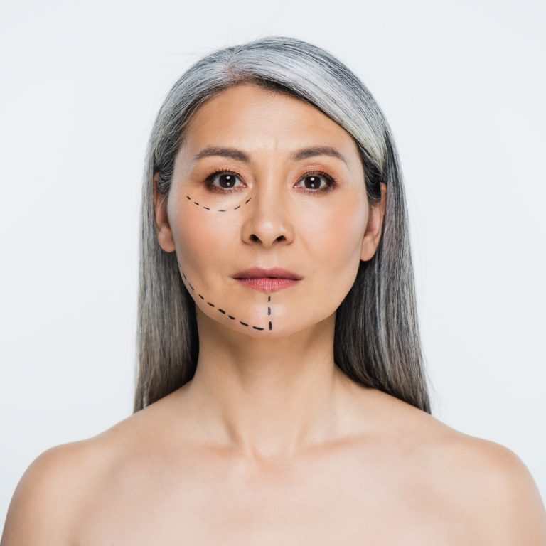 attractive naked asian woman with plastic surgery lines on face isolated on grey